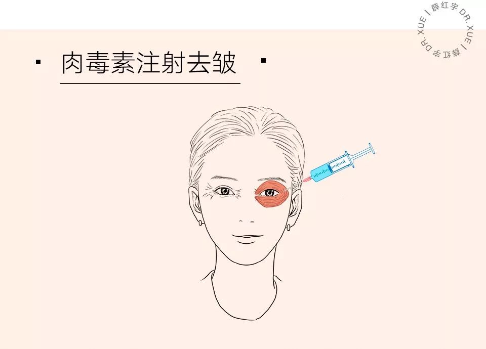 眼部抗衰最好方法,眼部抗衰效果图