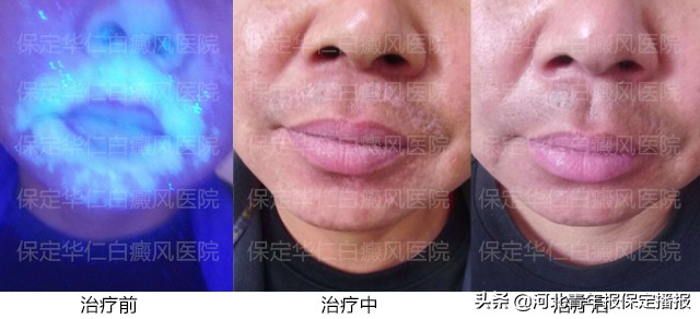 “他们待我如亲人”!患者辗转300余公里,连送保定华仁医院三面锦旗!