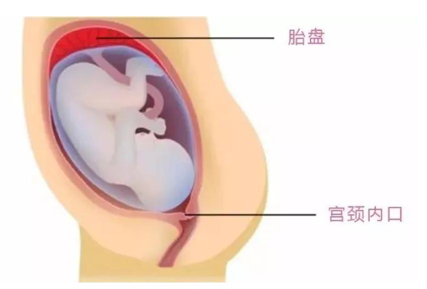 孕妇肚子疼了3小时才上医院,检查发现没了胎心