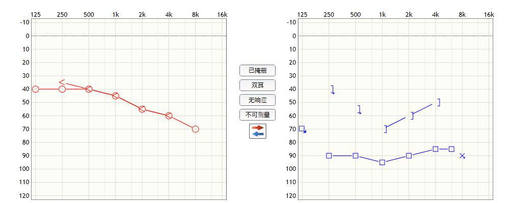 为什么助听器戴了声音小了,为什么戴助听器效果都不好呢