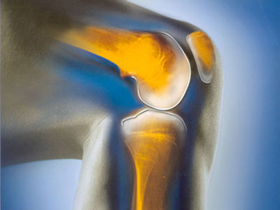 膝关节为何会退变？生活中少做哪些事，可预防膝骨关节炎？