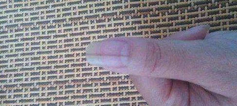 指甲表面长了竖纹，很多人恐慌自己身体不好？看完终于放心了