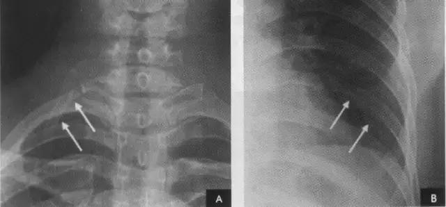 休闲小白鞋夏,献血小板相当于献血多少