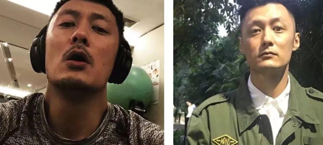 眉毛整容有几种方案,现在男生整容多吗