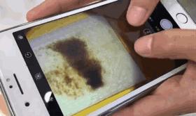 从床上吸出来的白色粉末是螨虫吗,生活窍门床单上的螨虫放大1000倍