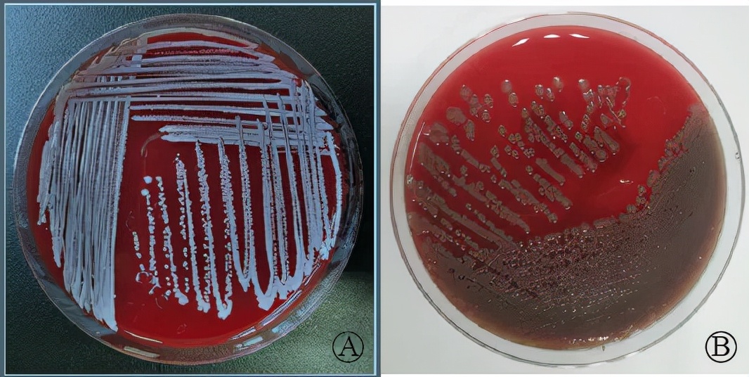 手术切口感染的主要病原菌是 (骨科一类切口感染原因分析)