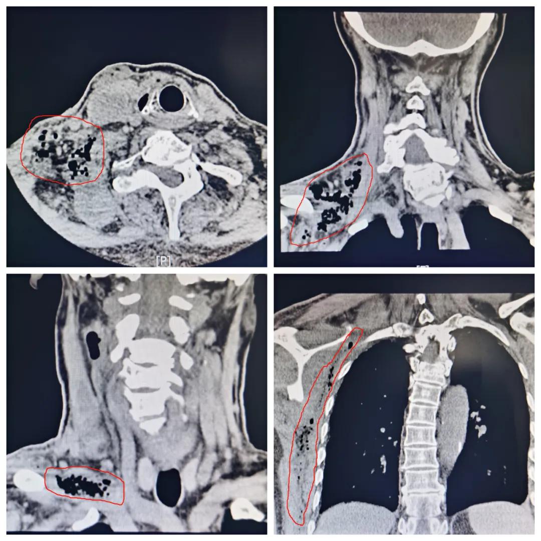 多么痛的领悟这句话是什么意思,嗓子疼感冒的感悟