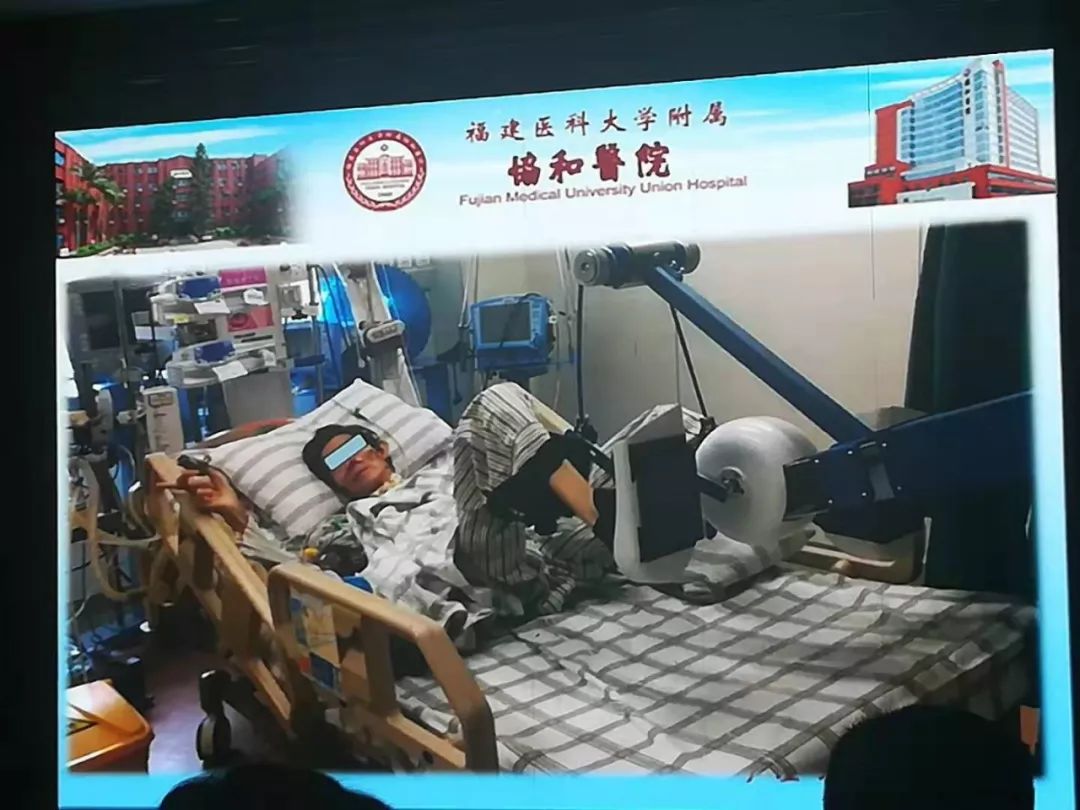 重症患者早期康复治疗,重症康复治疗的定义与意义