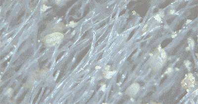 广州近期出现的变异蜗牛,深圳雨后巨型蜗牛