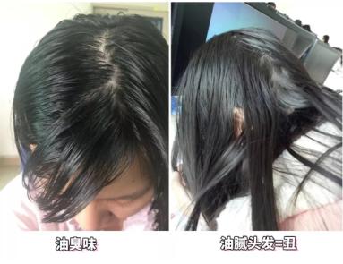 头发蓬松茶树油洗发水,油头救星澳洲茶树洗发水