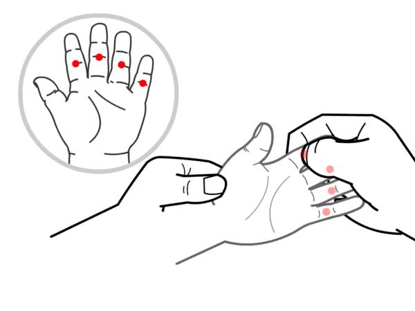 关于幼儿疱疹性咽颊炎的预防通知,疱疹性咽峡炎是不是越早发现越好