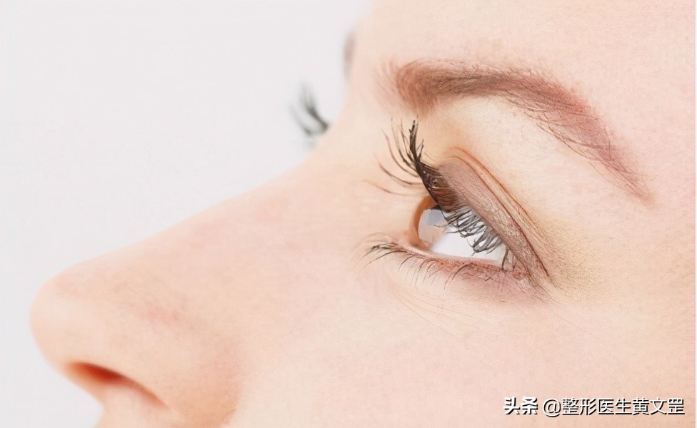 为什么眼皮一夜之间变成多层眼皮,怎么缓解多层眼皮