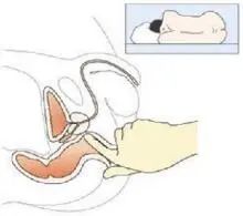 医生为什么要摸肚子,为什么医生会用手摸脖子