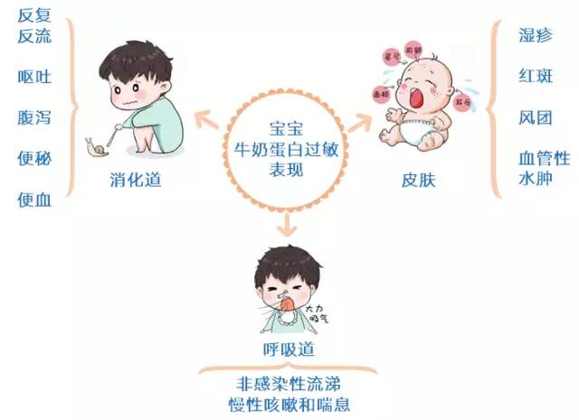 纯奶粉喂养的宝宝是不是容易便秘,如何判断奶粉喂养宝宝是否便秘