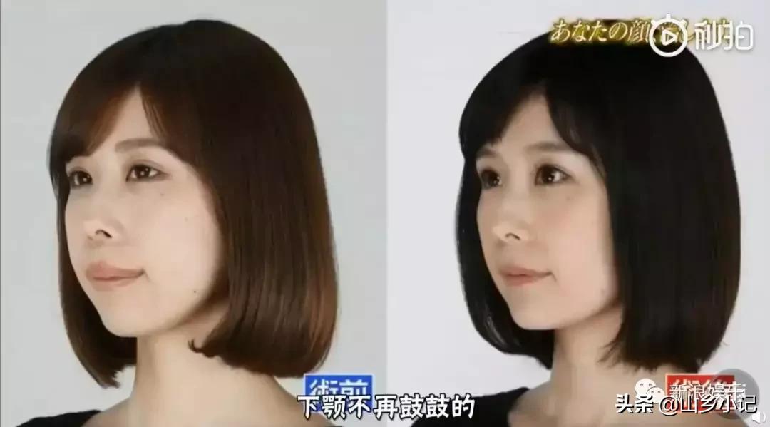 明明是整容脸现在却成了颜值巅峰,明明是整容脸却没被吐槽过