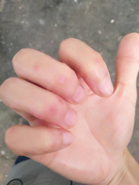 效果好又便宜常用药膏,几款管用的小药膏