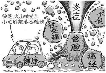 女性隐形杀手盆腔炎,盆腔炎杀手