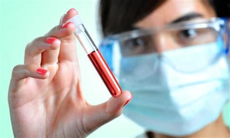 辟谣:痛风非布司他副作用大,尽量不服用。医生讲清楚用药细节