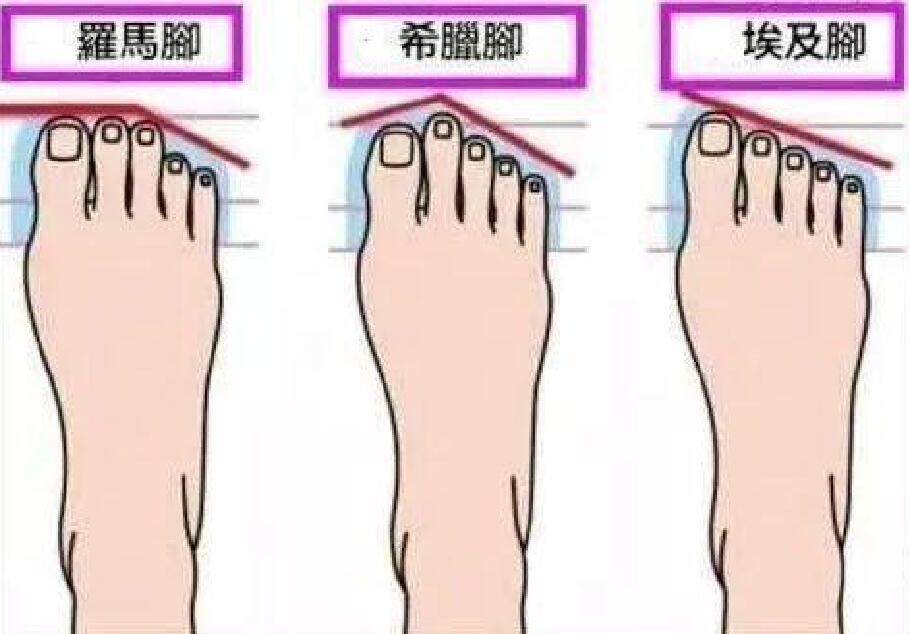 脚型不好看不敢穿凉鞋怎么办,什么脚型适合穿什么高跟凉鞋