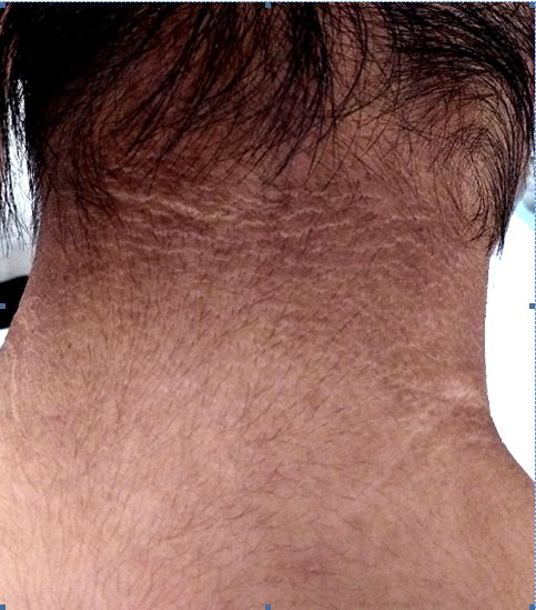 萝莉少女大长腿,为何腿毛长又黑?