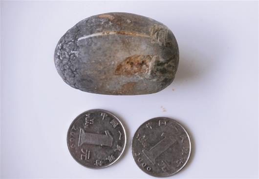 肾结石吃药后怎么能知道结石排出,肾结石4x4mm结石能排出吗