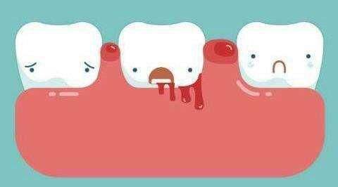 上火引起的牙龈什么症状,上火牙龈肿痛是细菌造成的吗