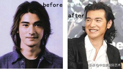 发际线最简单的补救方法,怎么有效的修复发际线