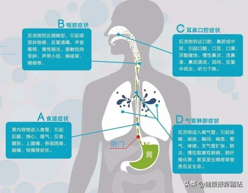 内镜下治疗胃食管反流手术怎么样,自治区人民医院做腹腔镜手术