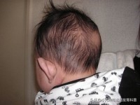 宝宝躺着头偏向一侧怎么纠正正睡,新生儿睡觉头老偏向一边怎么办