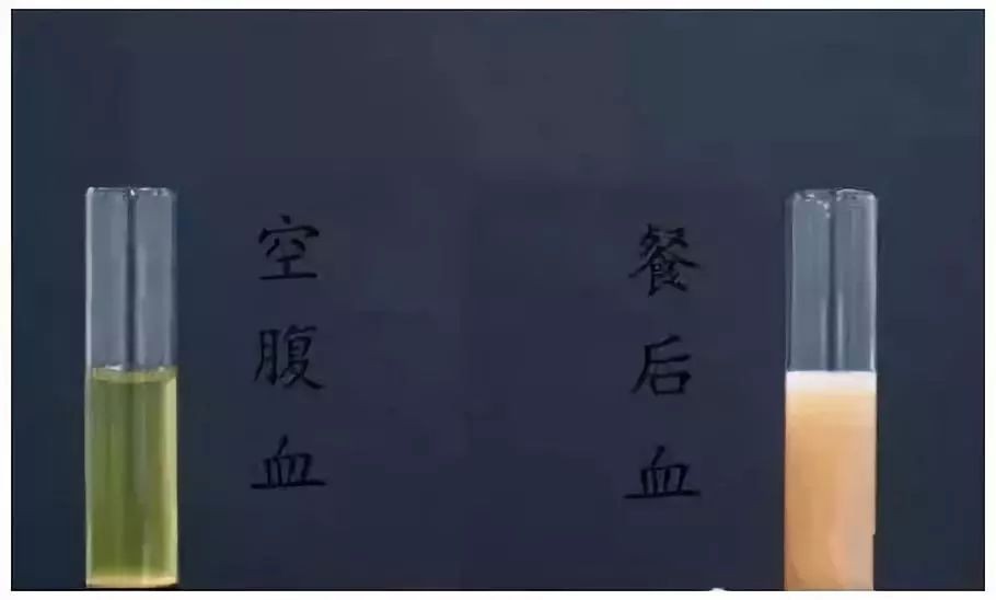 体检抽血那么多的内幕,体检抽血那么多背后真相是什么