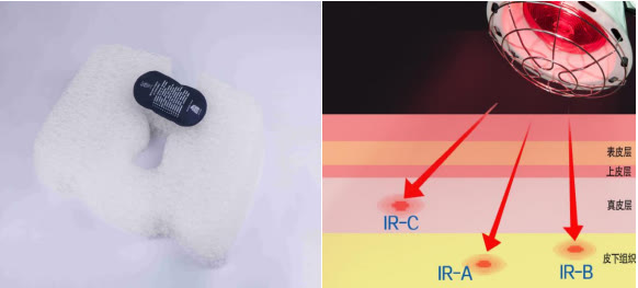 得了肛瘘屁会多吗,同时得了痔疮和肛瘘
