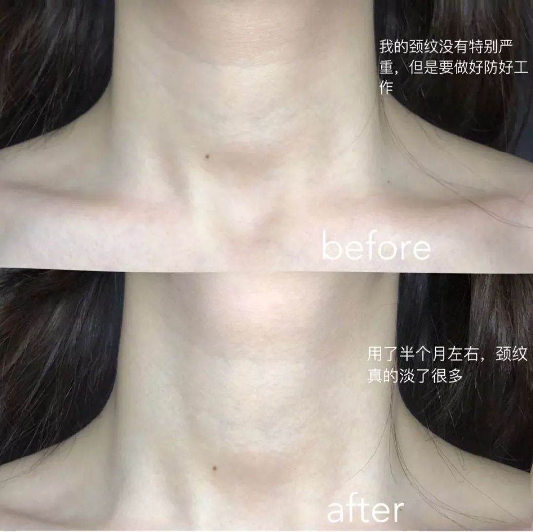 一年四季都能用的保湿面霜,皮肤干推荐一款好用的面霜