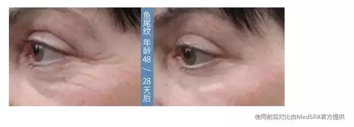 有了前法国第一夫人的百元“黑科技”眼霜，我把3000块眼霜扔了！