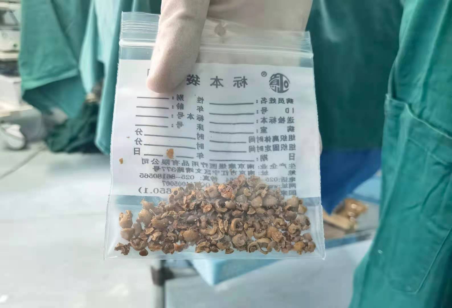 泌尿结石的治疗方法与分类,泌尿系结石的病人