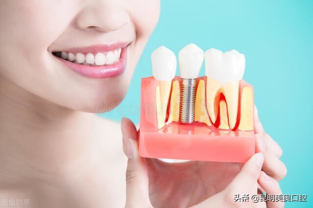 牙齿一般拔了多久能种牙,牙齿拔掉后多久种植牙比较好呢