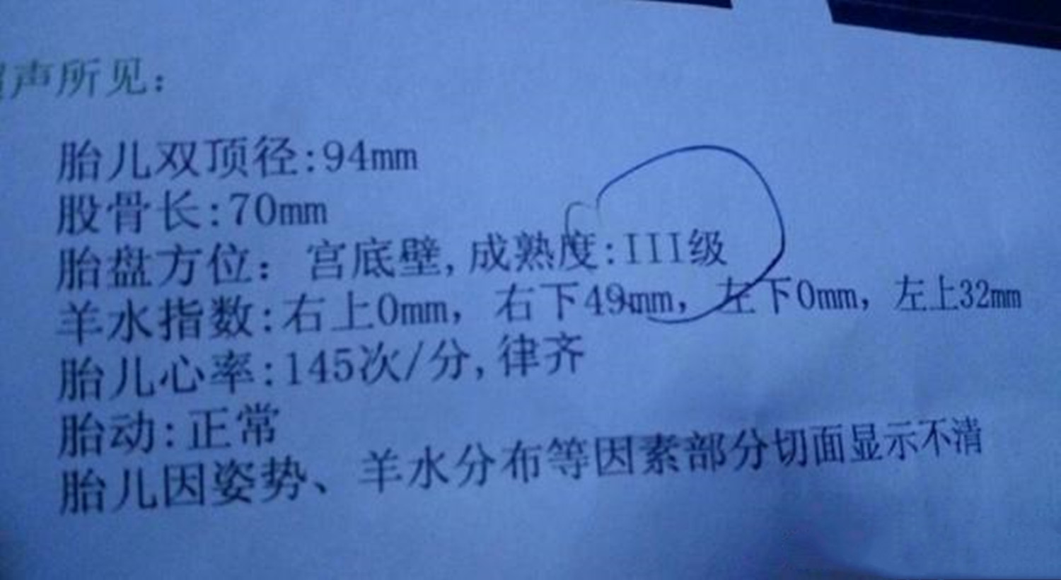 孕期看宝宝照片管用吗,孕期四维彩超看五官