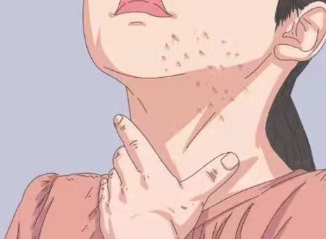 脖子上的小揪揪越抓越多！有可能是感染病毒！教你丝状疣该怎样治