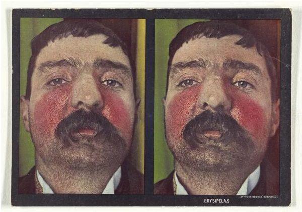 中国创新药现状,中国原创药与国外的差距