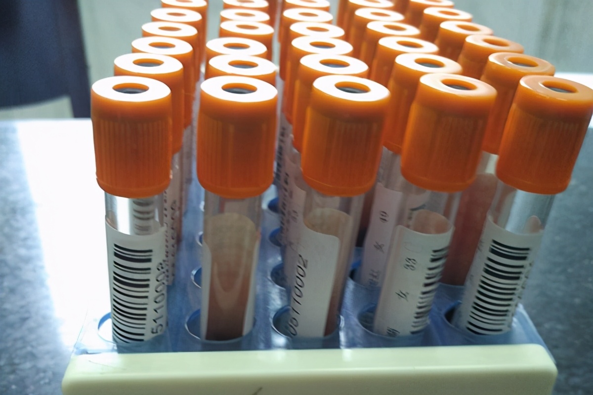 医院领的叶酸和药店的叶酸哪个好,医院的叶酸和买的几百的叶酸