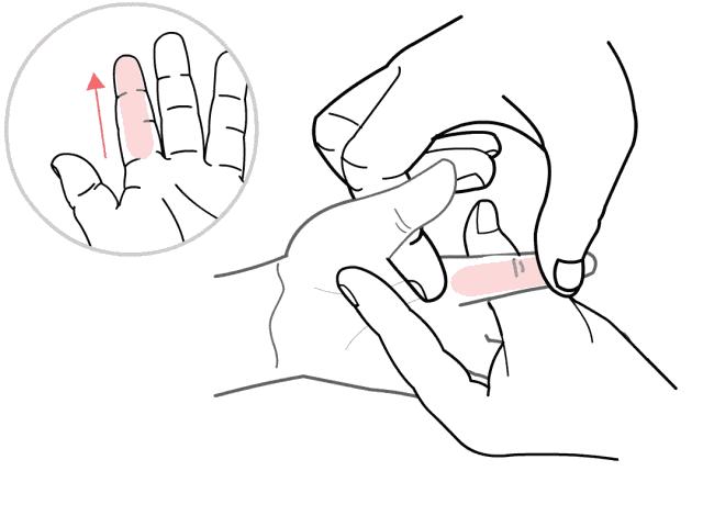 宝宝黄疸康复治疗,新生儿黄疸怎么退得快推拿手法