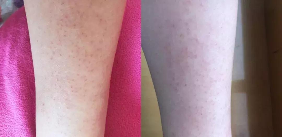 theordinary护肤品推荐,护肤圈成分theordinary