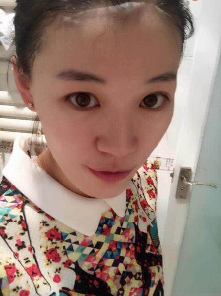 浪漫香榭丽淡斑,浪漫香榭丽补水