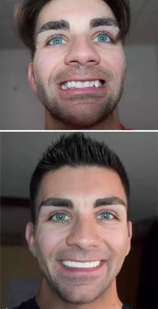 澶栧浗浜烘暣鐗欐晥鏋滃浘,闆呮偊榻跨绉嶇墮