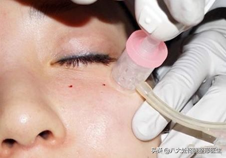 才20岁脸上有皱纹咋回事,才20岁就有皱纹了怎么办