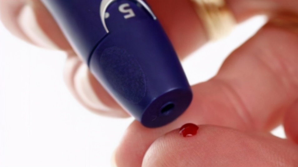 两千块种牙,上海雅悦齿科