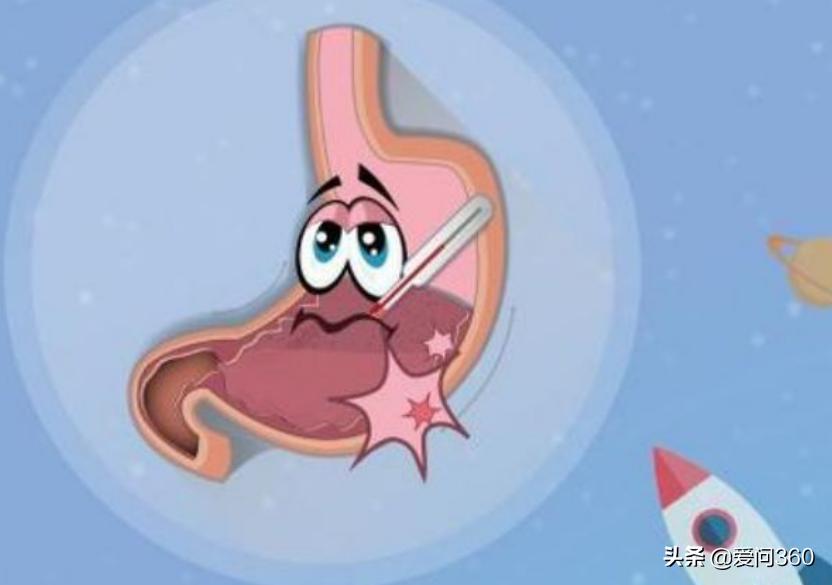 保护胃黏膜修复胃粘膜 (胃黏膜受损如何修复胃黏膜)