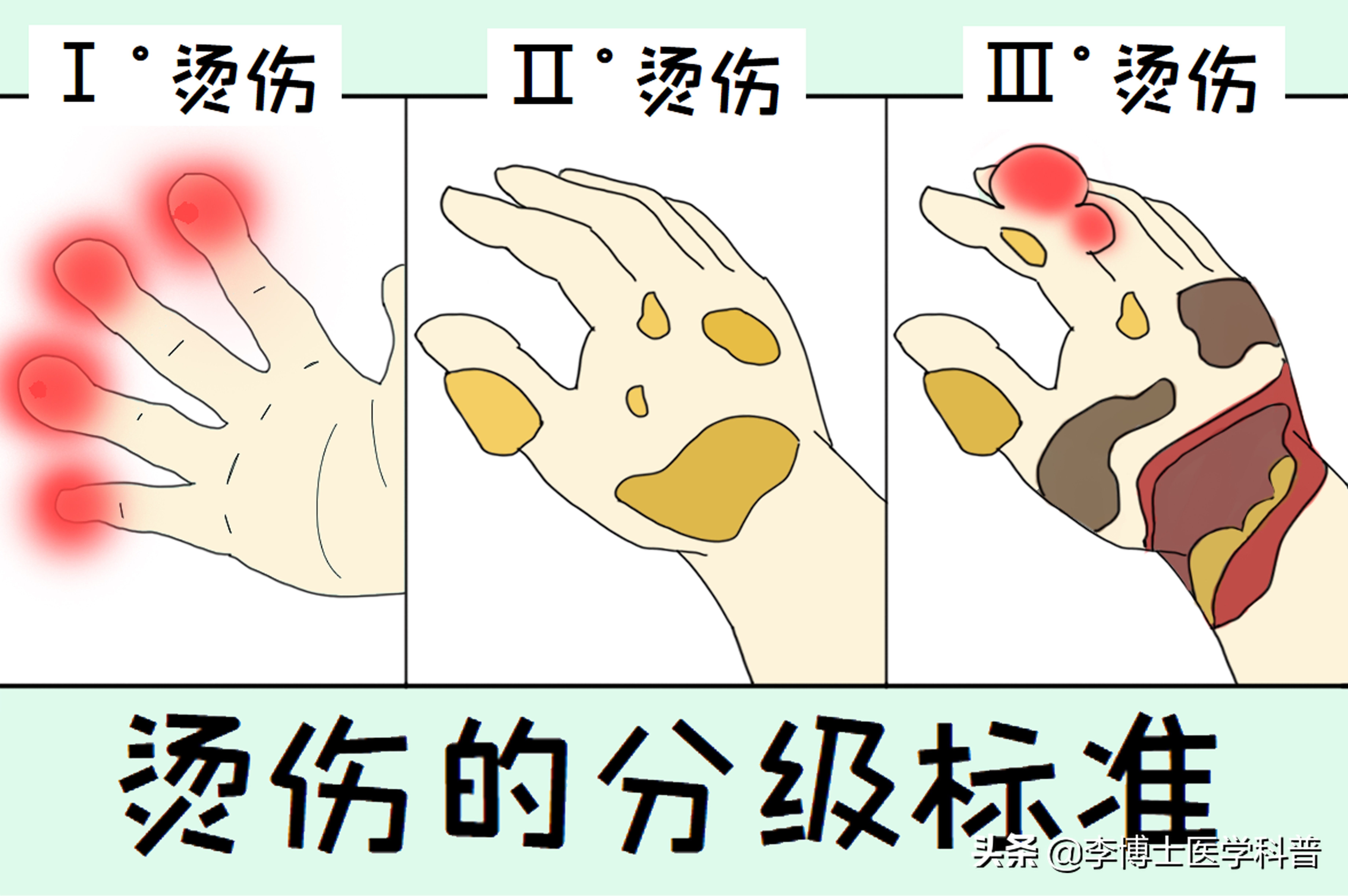 触电的急救知识,触电的常用技术措施