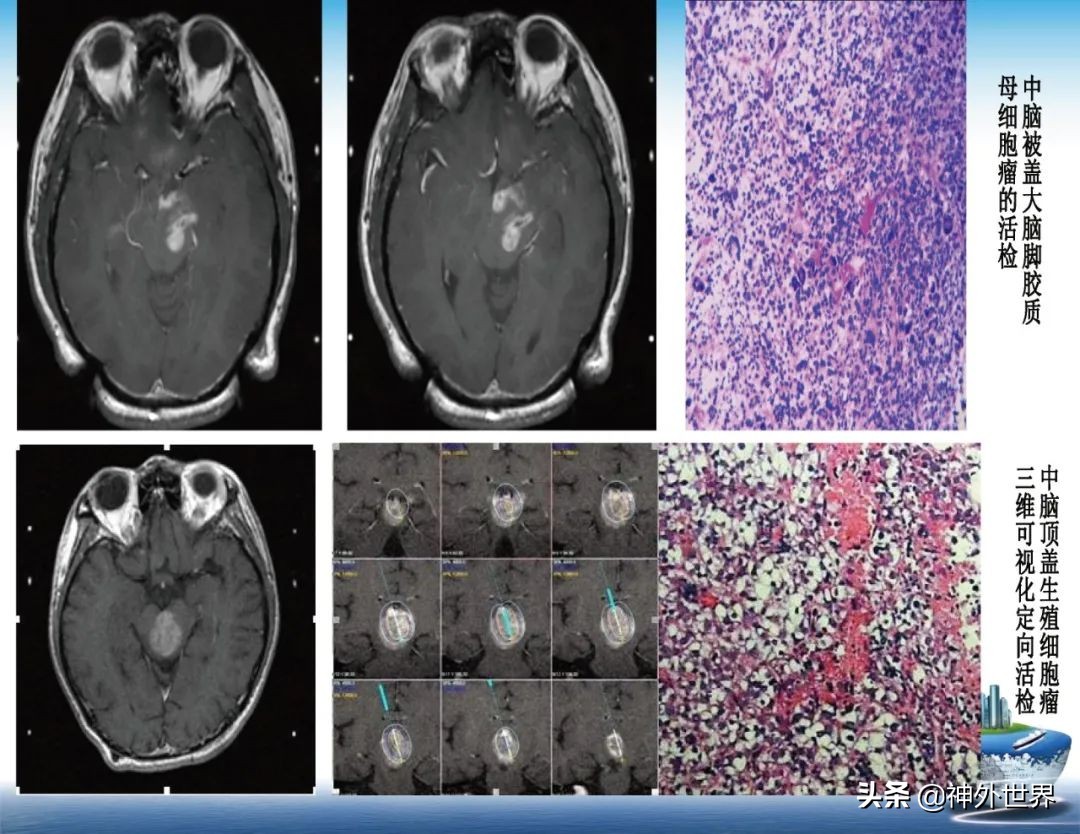 宣武医院神经外科王亚明祖籍,北京宣武医院神经科专家王亚明