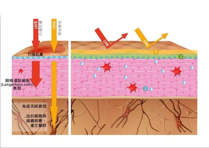 毛孔粗大抗炎,油脂性毛孔粗大怎么抗老