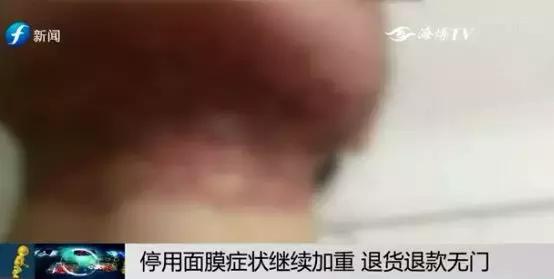 警惕微商,微商面膜的危害